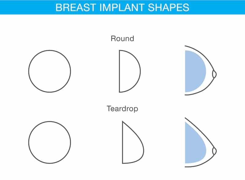 Round Breast Implant vs Teardrop Breast Impant